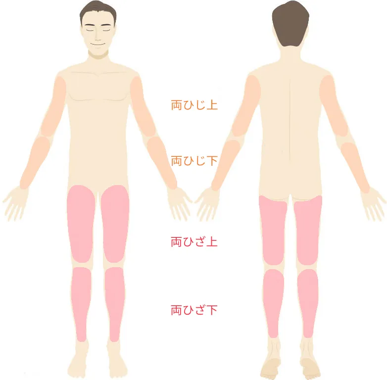 両ひじ上下・両ひざ上下脱毛 施術パーツ